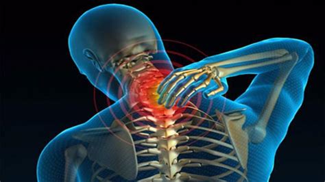 физиотерапия за остеохондроза на шийния отдел на гръбначния стълб е